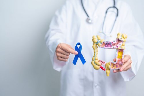 Aumentan los casos de cáncer de colon en adultos jóvenes 🏥