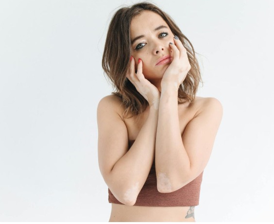 La era del anti-perfeccionismo: Por qué la “belleza imperfecta” conecta más (y qué deben cambiar las marcas)  👀