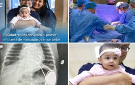 Por primera vez en Latinoamérica médicos peruanos implantan un marcapasos a bebé prematura  👏